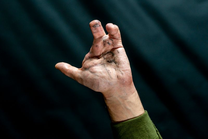 Photo essay  - " Surviving the Pager Massacre "